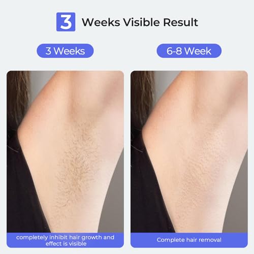 IPL Laser Hair Removal Device X20178